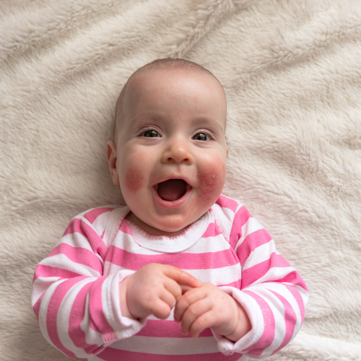 PAEDIPROTECT Blog 14 Neurodermitis bei Babys und Kindern vorbeugen