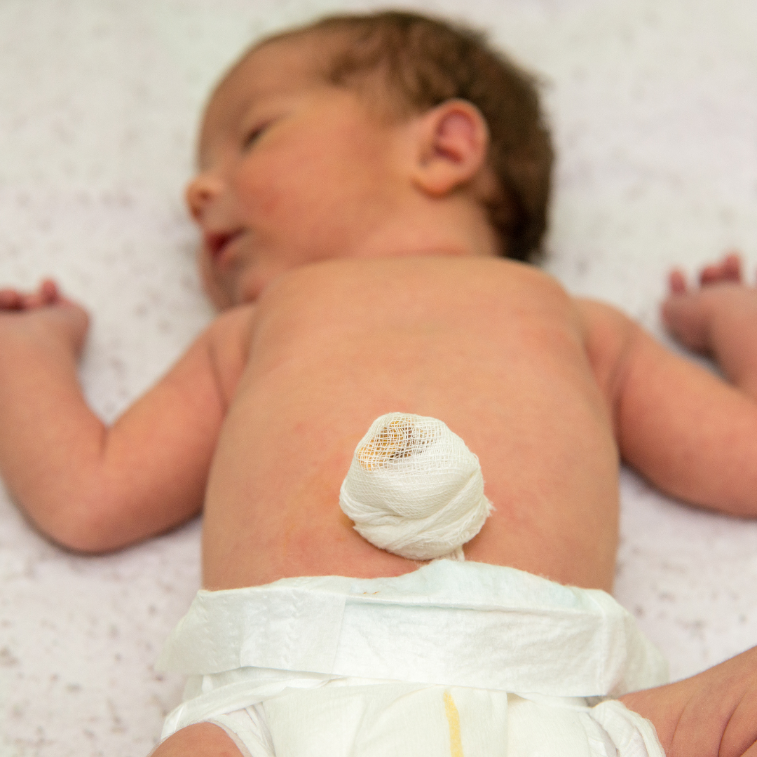 Neugeborenes Baby mit Nabelklemme am Nabelschnurrest. Neugeborenes Baby mit Nabelklemme am Nabelschnurrest.