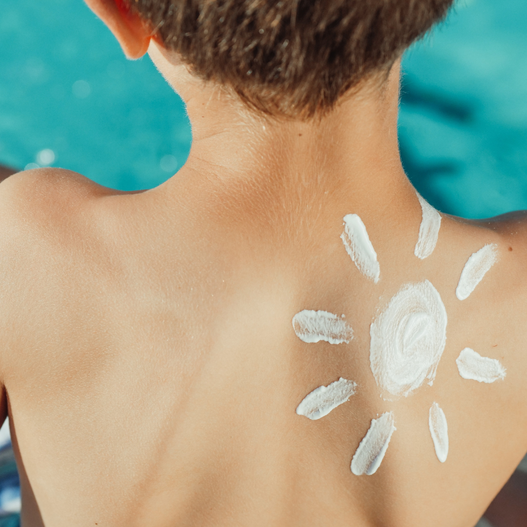 Sonnencreme Sonne auf dem Rücken sonnenschutz: Junge mit einer auf den Rücken gezeichneten Sonnencreme-Sonne